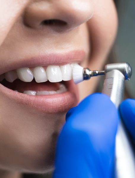 Closeup of patient receiving teeth cleaning