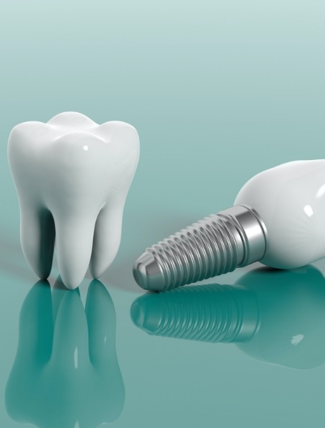 Animated tooth and dental implant supported dental crown