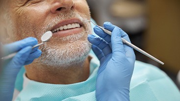 Nose-to-shoulder view of man with white beard about to have dental exam
