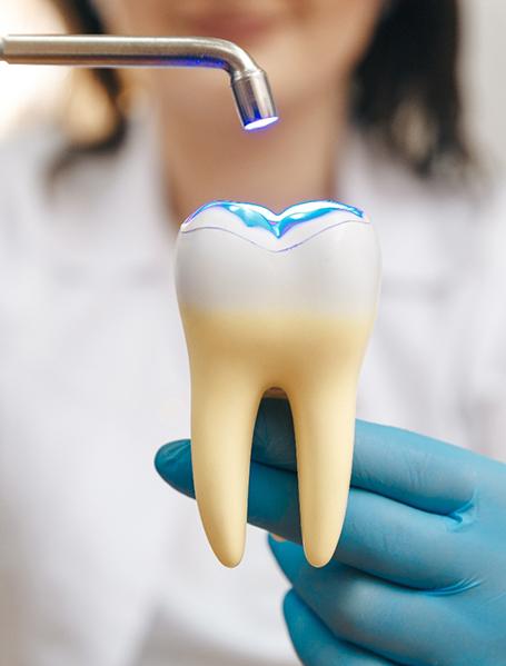 Dentist demonstrating dental bonding on large model tooth