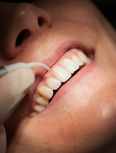 Patient receiving laser periodontal therapy