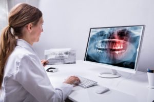 dental scan on screen