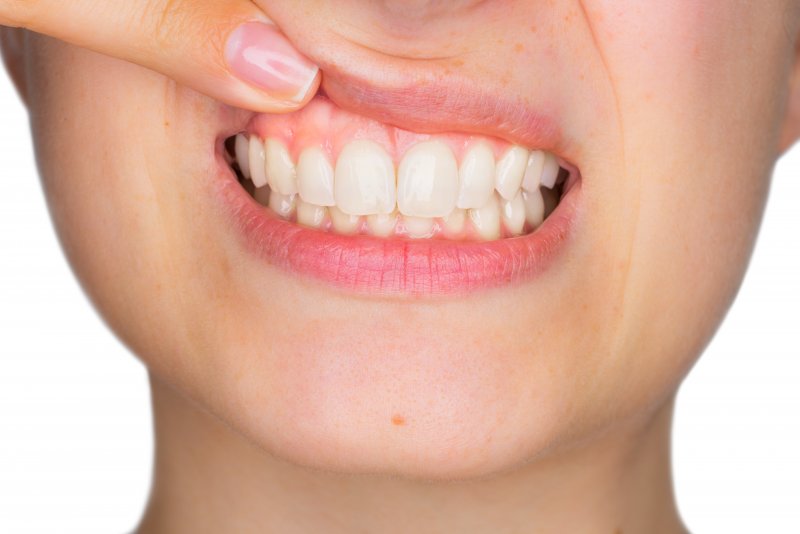 Woman showing off healthy gums
