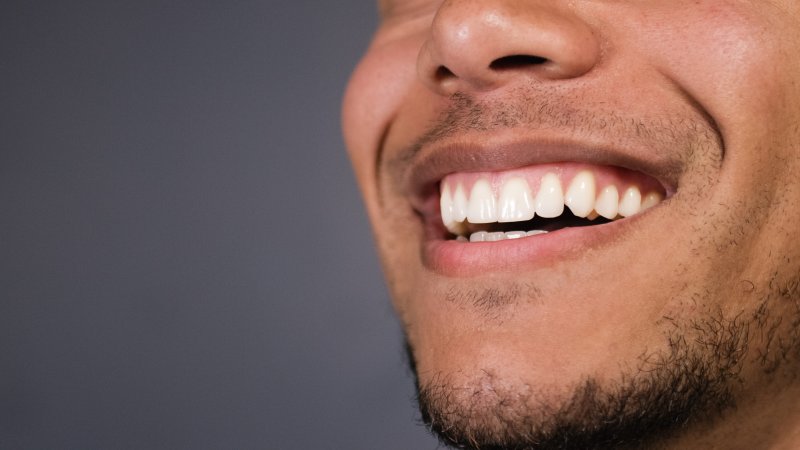 Man smiling after cosmetic dentistry in Hamden