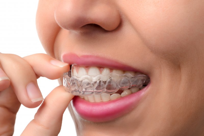 closeup of someone putting on their aligner