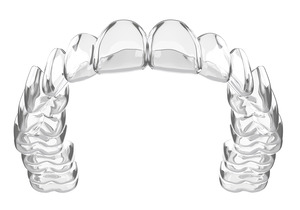 Close-up of Invisalign aligner against a white background